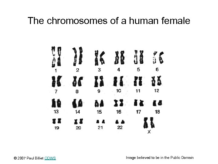 The chromosomes of a human female © 2007 Paul Billiet ODWS Image believed to