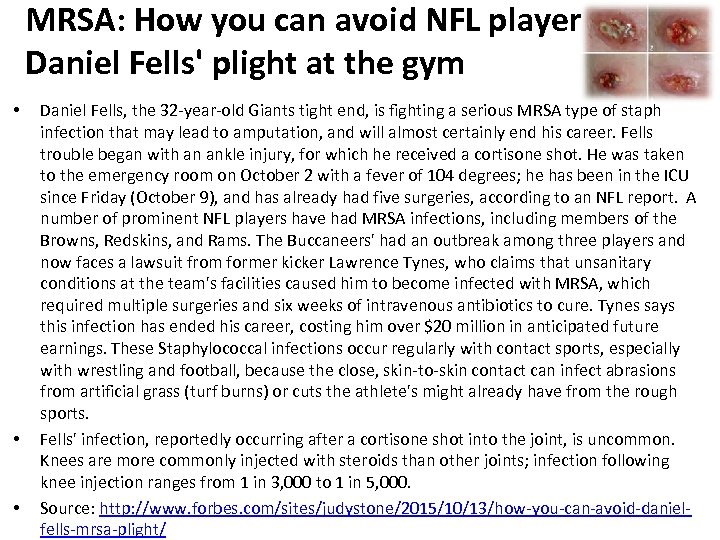 MRSA: How you can avoid NFL player Daniel Fells' plight at the gym •