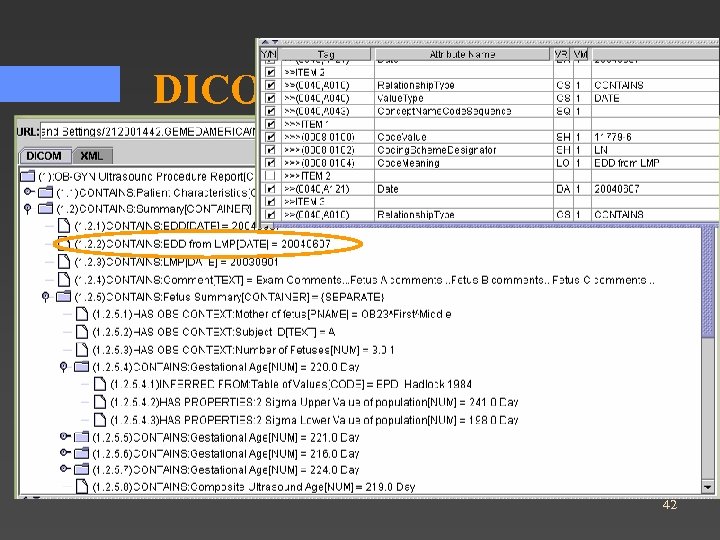 DICOM SR Example 42 