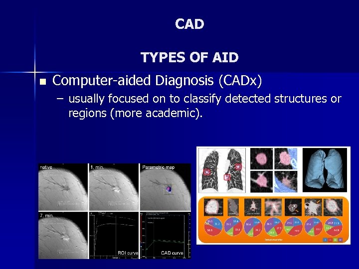 CAD TYPES OF AID n Computer-aided Diagnosis (CADx) – usually focused on to classify