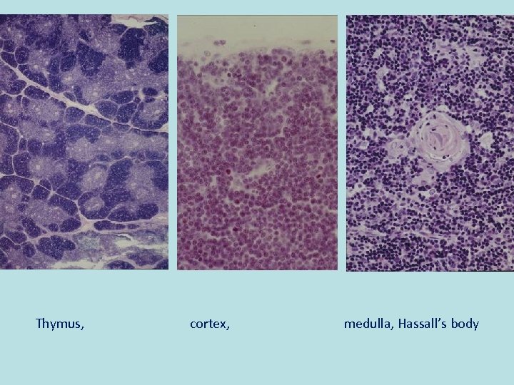 Thymus, cortex, medulla, Hassall’s body 