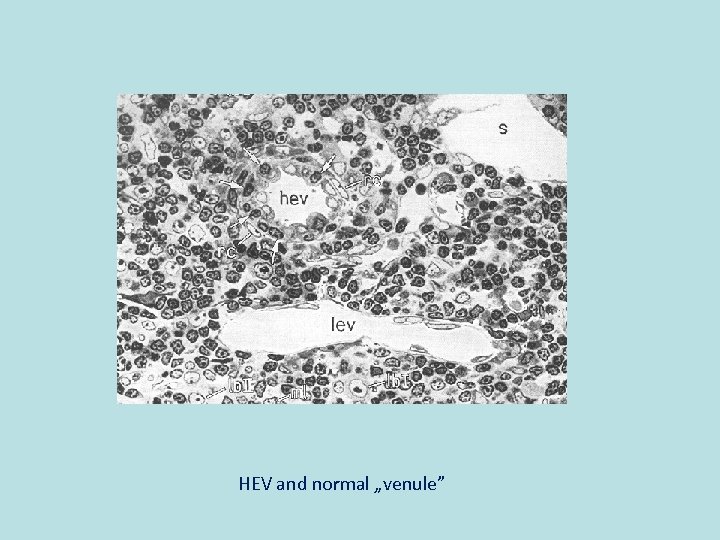 HEV and normal „venule” 