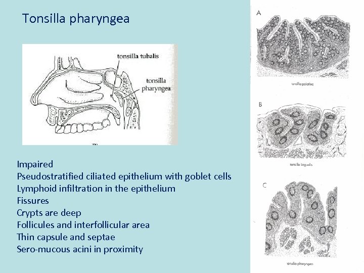 Tonsilla pharyngea Impaired Pseudostratified ciliated epithelium with goblet cells Lymphoid infiltration in the epithelium