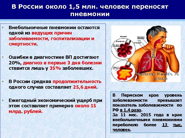 В России около 1, 5 млн. человек переносят пневмонии • Внебольничные пневмонии остаются одной