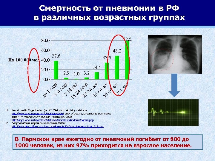 Смертность от пневмонии в РФ в различных возрастных группах 78. 5 80. 0 60.