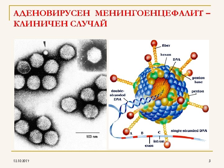 AДЕНОВИРУСЕН МЕНИНГОЕНЦЕФАЛИТ – КЛИНИЧЕН СЛУЧАЙ 12. 10. 2017 3 