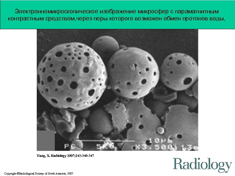 Электронномикроскопическоеmicroscopic image of polymeric microspheres Figure 1 a: (a) Electron изображение микросфер с парамагнитным