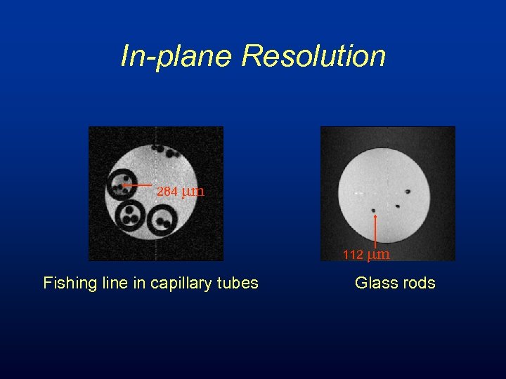 In-plane Resolution 284 mm 112 mm Fishing line in capillary tubes Glass rods 