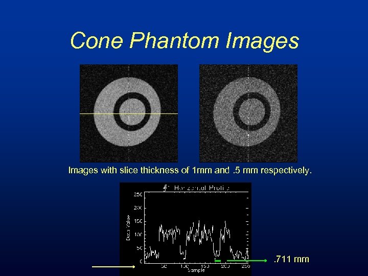Cone Phantom Images with slice thickness of 1 mm and. 5 mm respectively. .