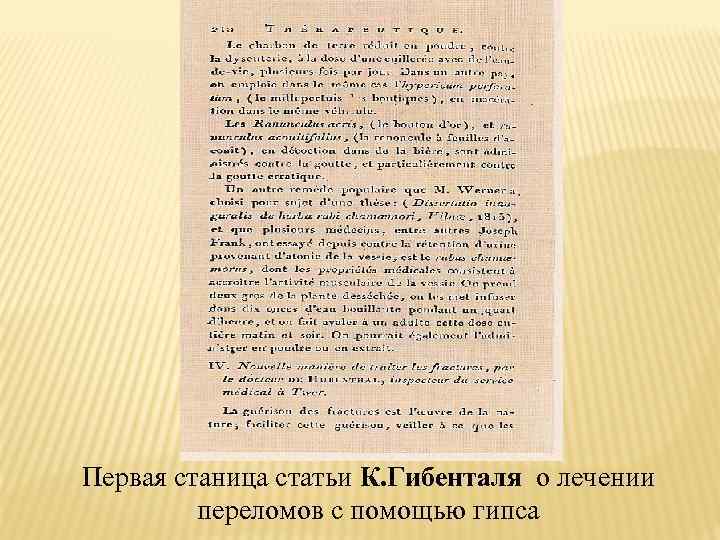 Первая станица статьи К. Гибенталя о лечении   переломов с помощью гипса 