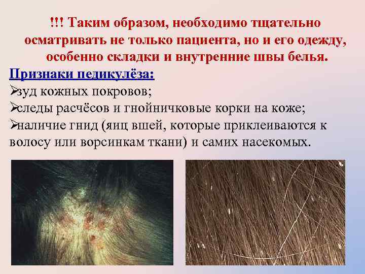  !!! Таким образом, необходимо тщательно  осматривать не только пациента, но и его