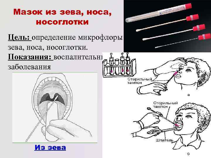 Мазок из зева картинки