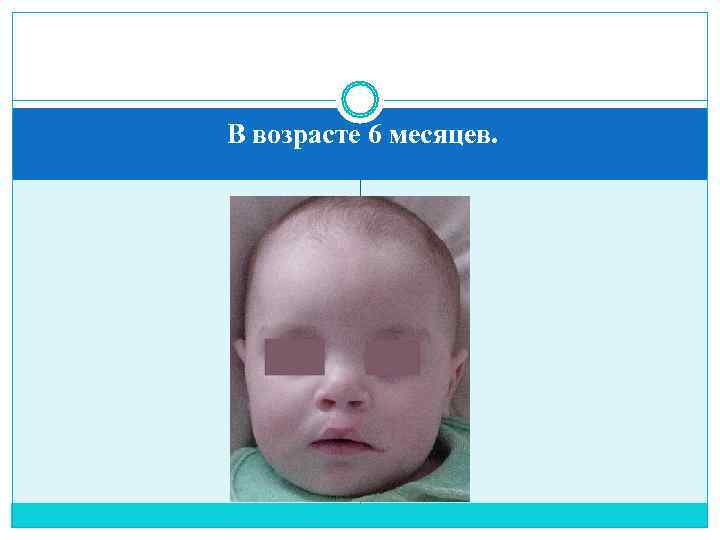 В возрасте 6 месяцев. 