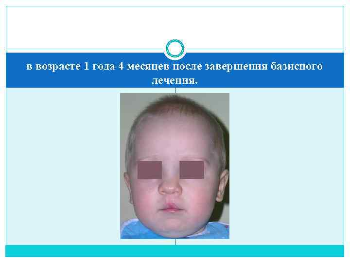 в возрасте 1 года 4 месяцев после завершения базисного     лечения.