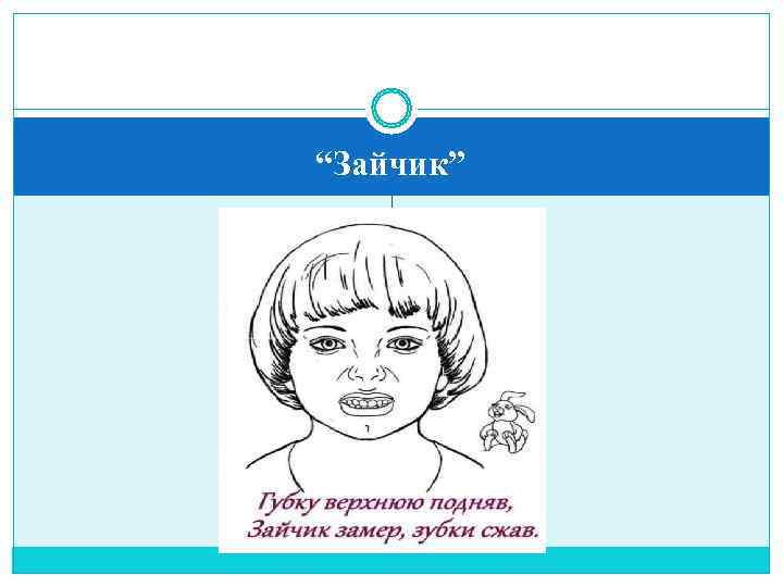 “Зайчик” 