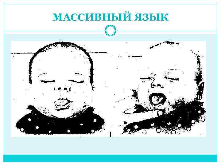 МАССИВНЫЙ ЯЗЫК 