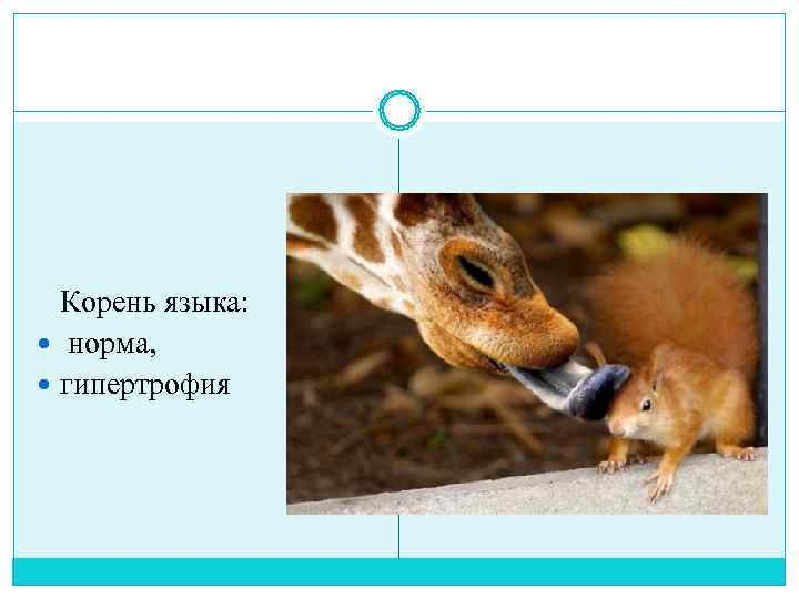  Корень языка: норма, гипертрофия 