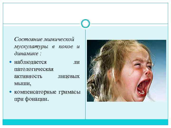  Состояние мимической  мускулатуры в покое и  динамике :  наблюдается 