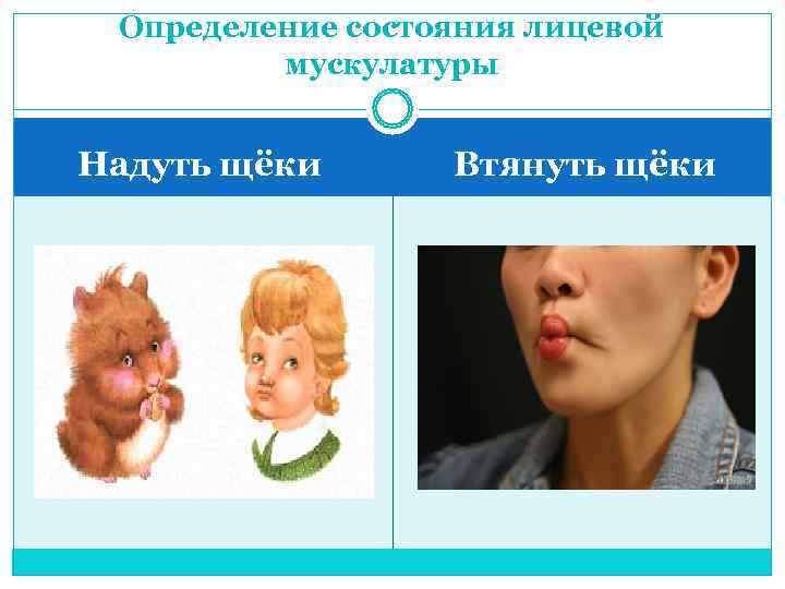  Определение состояния лицевой   мускулатуры  Надуть щёки  Втянуть щёки 
