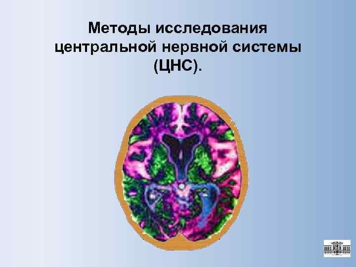   Методы исследования центральной нервной системы  (ЦНС). 