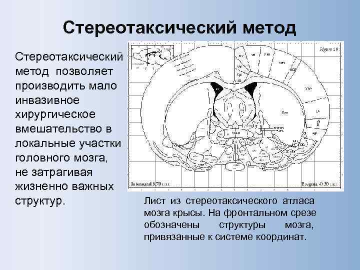   Стереотаксический метод Cтереотаксический метод позволяет производить мало инвазивное хирургическое вмешательство в локальные