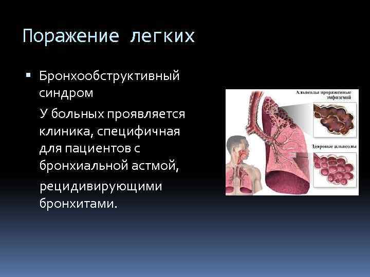 Поражение легких  Бронхообструктивный  синдром  У больных проявляется  клиника, специфичная 