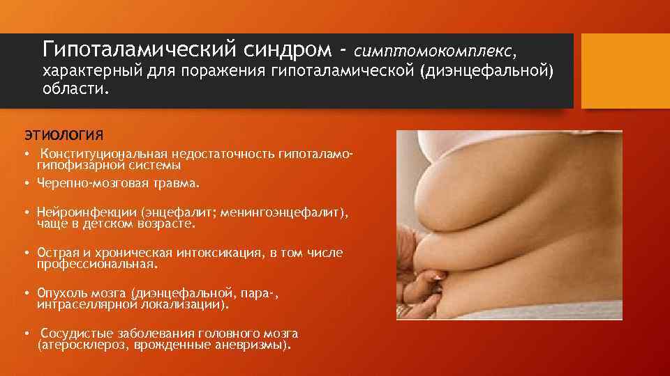  Гипоталамический синдром -   симптомокомплекс,  характерный для поражения гипоталамической (диэнцефальной) 