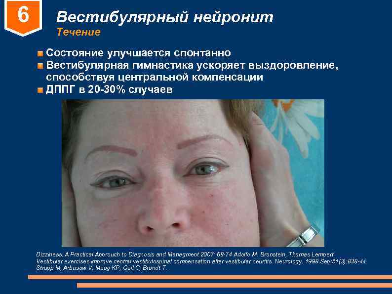 6 Вестибулярный нейронит Течение Состояние улучшается спонтанно Вестибулярная гимнастика 6 Вестибулярный нейронит Течение Состояние улучшается спонтанно Вестибулярная гимнастика