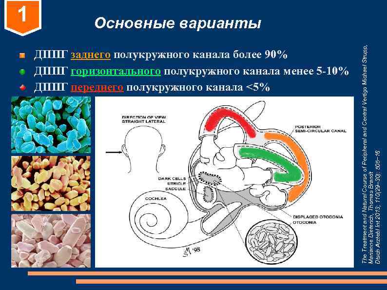1 Основные варианты 1 Основные варианты