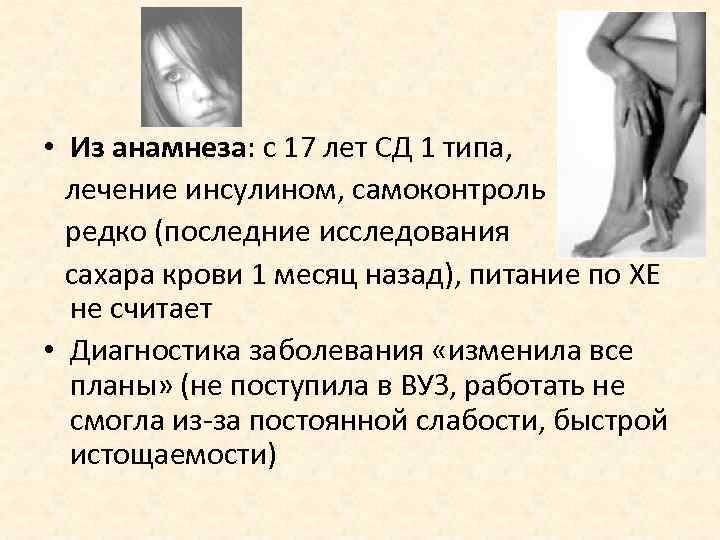  • Из анамнеза: с 17 лет СД 1 типа,  лечение инсулином, самоконтроль