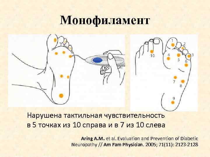 Орган тактильной чувствительности