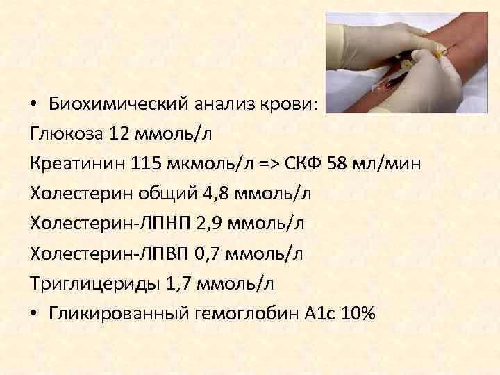  • Биохимический анализ крови: Глюкоза 12 ммоль/л Креатинин 115 мкмоль/л => СКФ 58