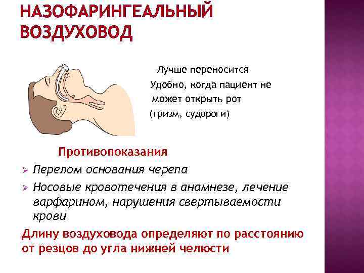НАЗОФАРИНГЕАЛЬНЫЙ ВОЗДУХОВОД Лучше переносится Удобно, когда пациент НАЗОФАРИНГЕАЛЬНЫЙ ВОЗДУХОВОД Лучше переносится Удобно, когда пациент