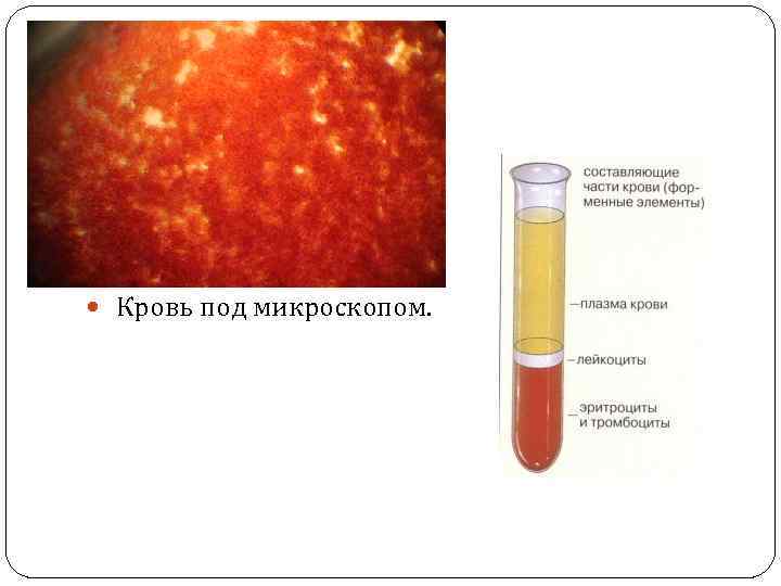  Кровь под микроскопом. 