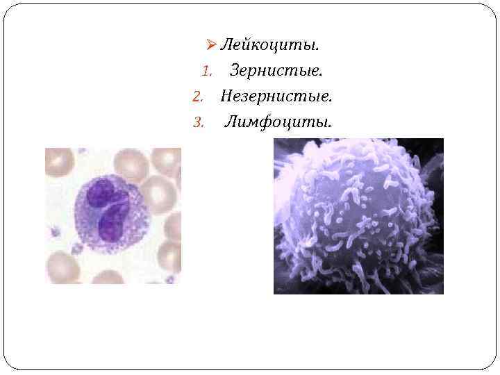 Лейкоцитов в 1 мм. Агранулоциты (незернистые лейкоциты):. Лимфоциты зернистые и незернистые. Лейкоциты зернистые и незернистые схема. Незернистые лейкоциты моноцит и лимфоцит.