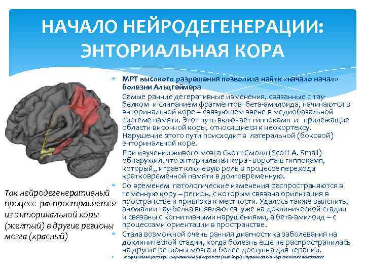    НАЧАЛО НЕЙРОДЕГЕНЕРАЦИИ:    ЭНТОРИАЛЬНАЯ КОРА    