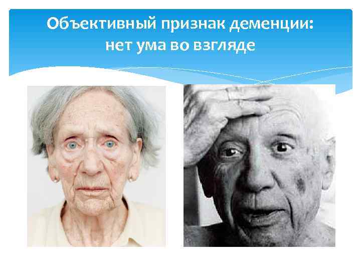 Объективный признак деменции:  нет ума во взгляде 