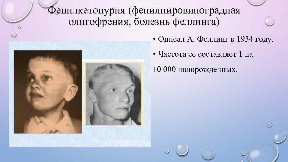 Фенилкетонурия (фенилпировиноградная  олигофрения, болезнь феллинга)     • Описал А. Феллинг