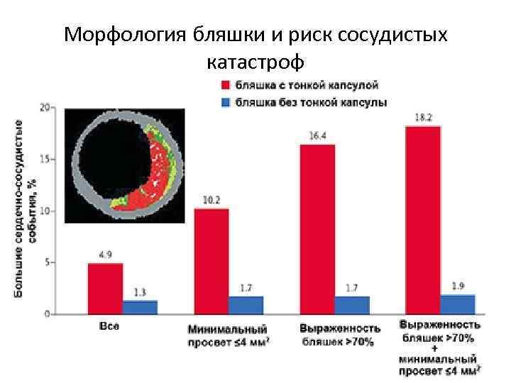 Морфология бляшки и риск сосудистых   катастроф 
