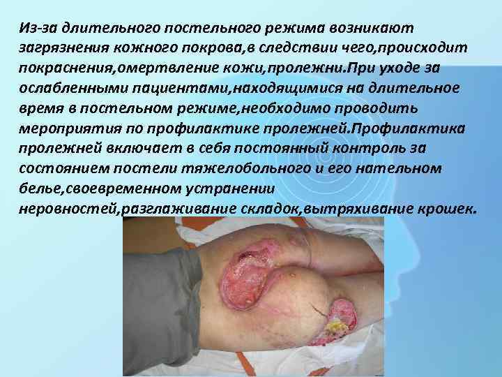 Из-за длительного постельного режима возникают загрязнения кожного покрова, в следствии чего, происходит покраснения, омертвление