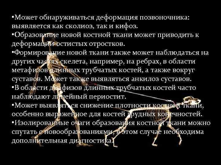  • Может обнаруживаться деформация позвоночника:  выявляется как сколиоз, так и кифоз. 