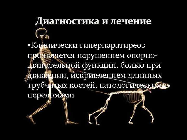  Диагностика и лечение  • Клинически гиперпаратиреоз проявляется нарушением опорно- двигательной функции, болью
