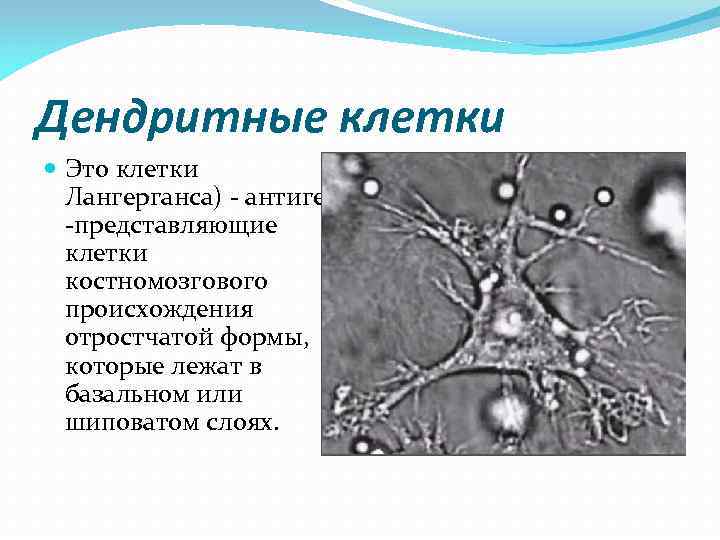 Дендритные клетки Это клетки Лангерганса) - антиген -представляющие клетки Дендритные клетки Это клетки Лангерганса) - антиген -представляющие клетки