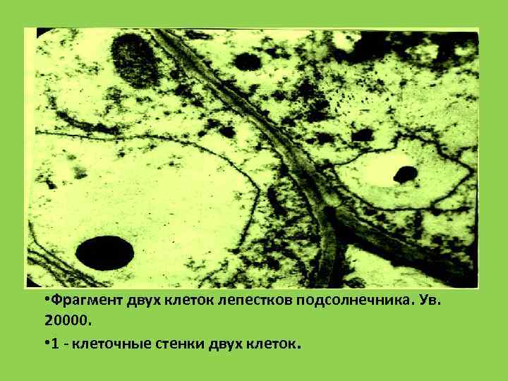  • Фрагмент двух клеток лепестков подсолнечника. Ув.  20000.  • 1 