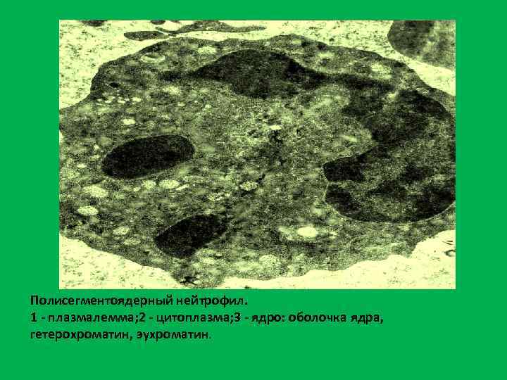 Полисегментоядерный нейтрофил. 1 - плазмалемма; 2 - цитоплазма; 3 - ядро: оболочка ядра, гетерохроматин,