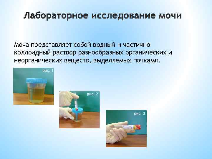 Моча представляет собой водный и частично коллоидный раствор разнообразных органических и неорганических веществ, выделяемых