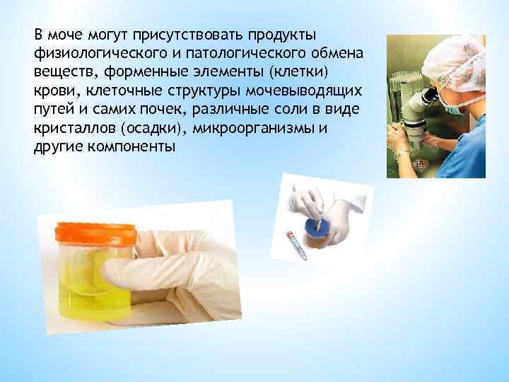 В моче могут присутствовать продукты физиологического и патологического обмена веществ, форменные элементы (клетки) крови,