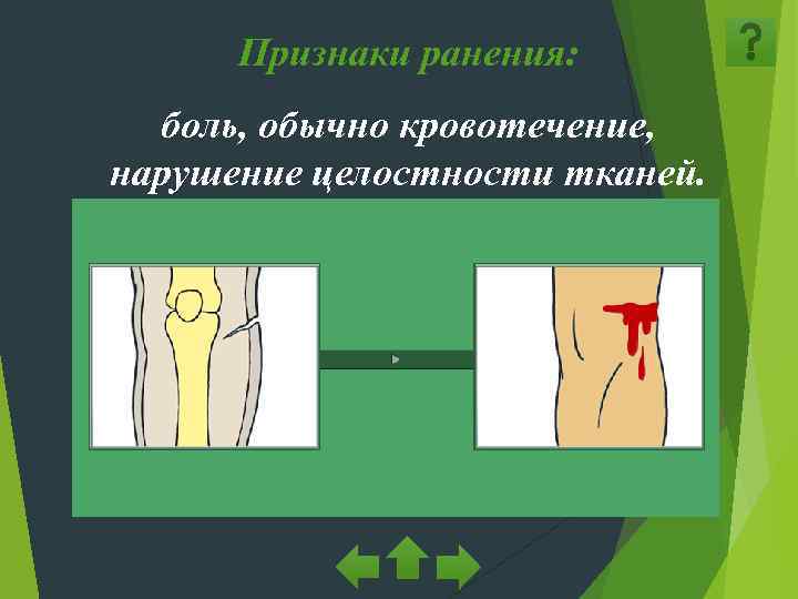  Признаки ранения:  боль, обычно кровотечение, нарушение целостности тканей. 