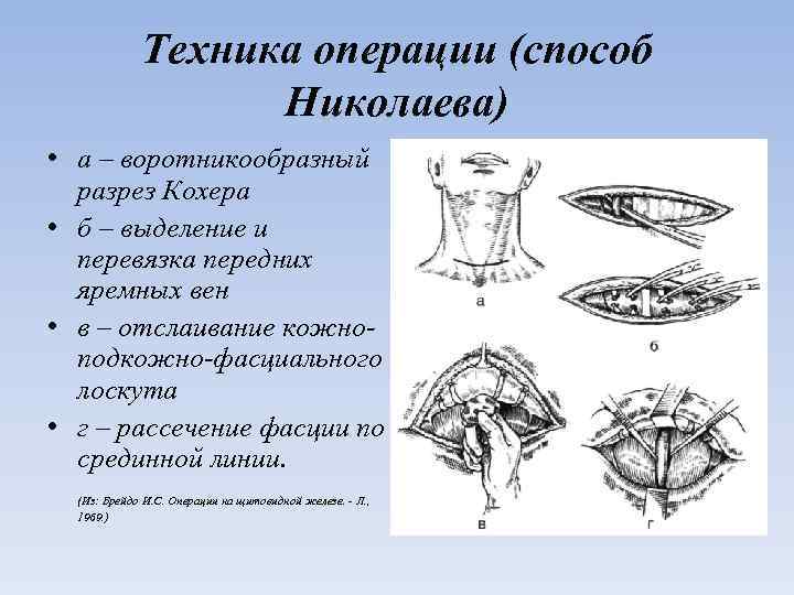 Техника операций. Воротникообразный разрез. Воротникообразный разрез кохера. Разрез по Кохеру к щитовидной железе.