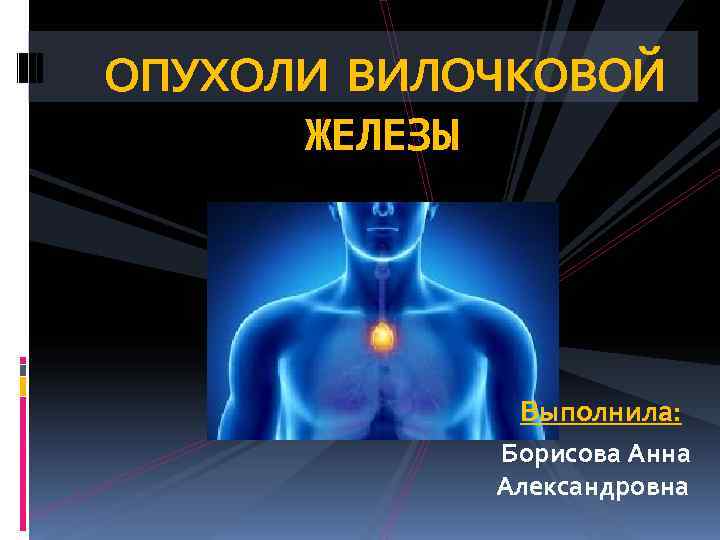 ОПУХОЛИ ВИЛОЧКОВОЙ  ЖЕЛЕЗЫ   Выполнила:   Борисова Анна   Александровна